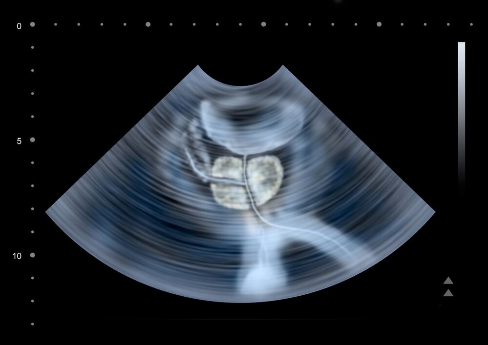 diagnosis of the prostate