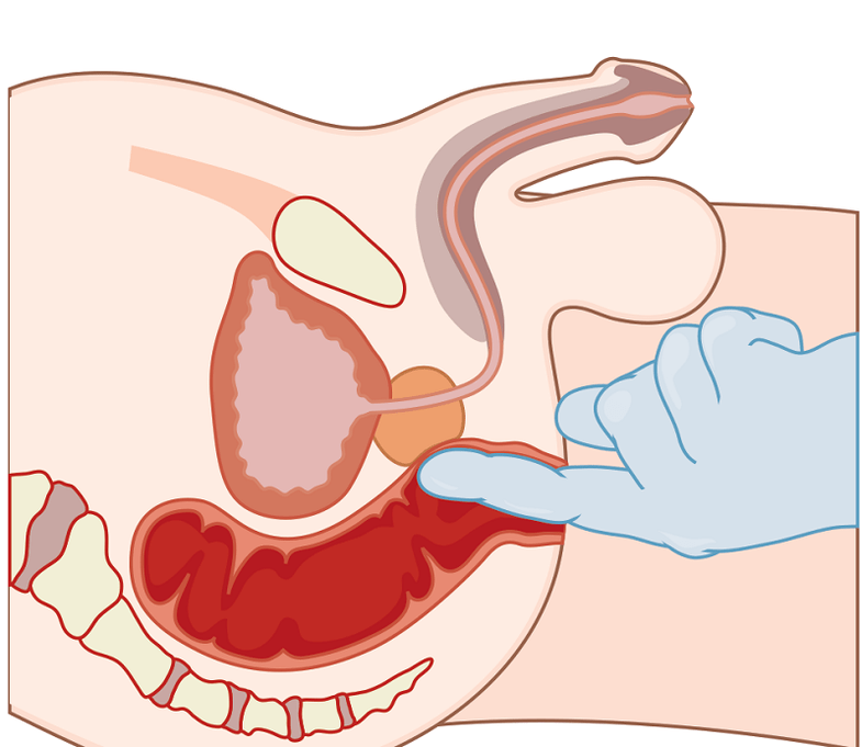 Prostate massage with prostate