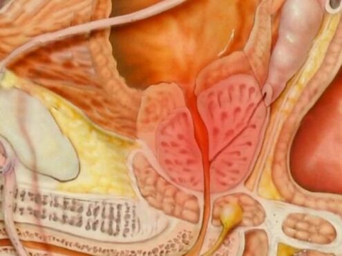The type of a person's healthy prostate